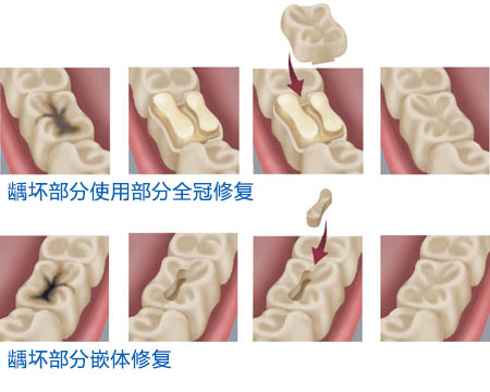 牙齿缺损333333.jpg